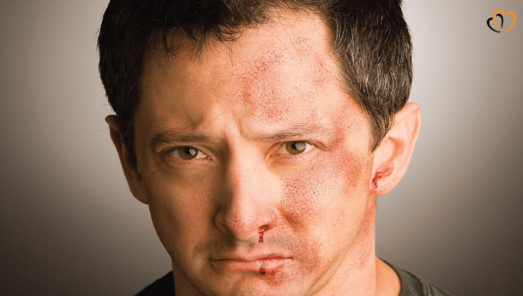 surviving-domestic-violence-abuse-1